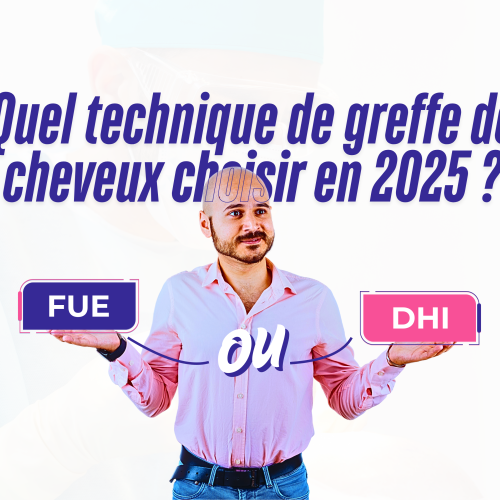 Greffe de cheveux FUE vs DHI : Quelle technique choisir en 2025 ?