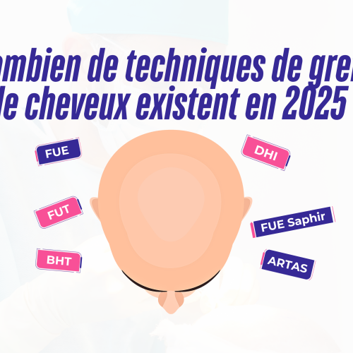 Combien de techniques de greffe de cheveux existent en 2025 ?